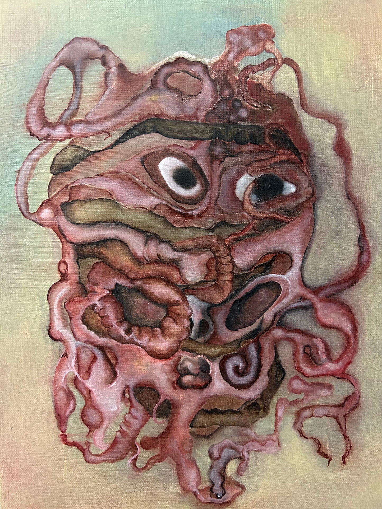 "Headache"