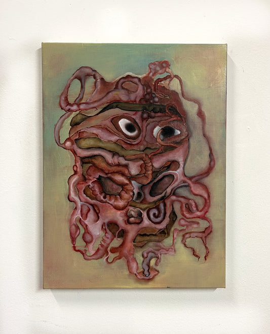 "Headache"